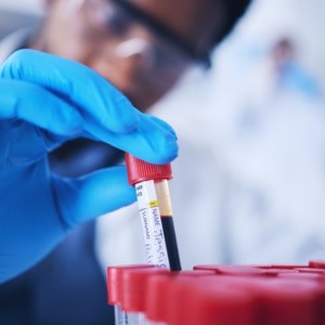 Free Cholesterol Analysis