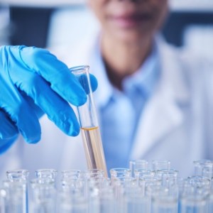 Free Fatty Acid Analysis